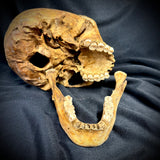 Item 14. Human skull with mandible