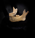 A mandible