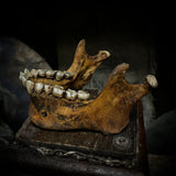 A mandible