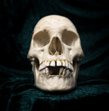 Medically prepared human skull