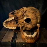 Item 1. Human skull with mandible