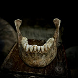 A mandible