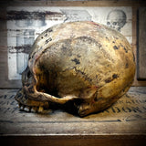 Human skull