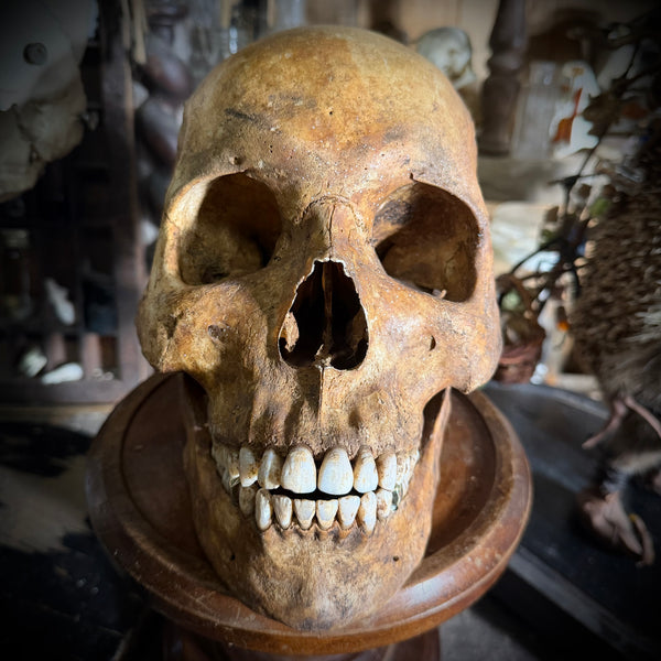 Human skull with mandible and brass teeth