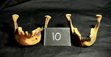 Item 10. Two human mandibles