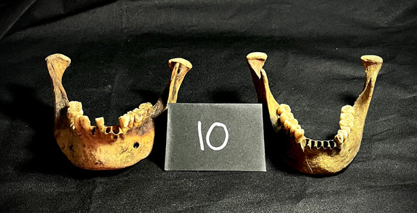 Item 10. Two human mandibles