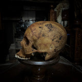 Human skull