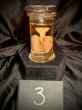 Item 3. Fetal lungs and heart