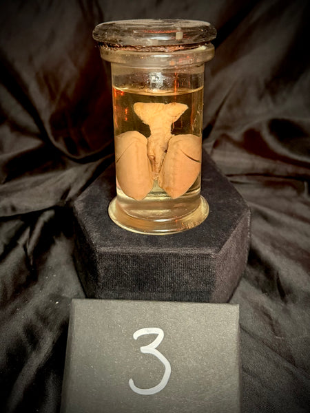 Item 3. Fetal lungs and heart