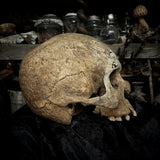 Human skull