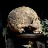 A human skull
