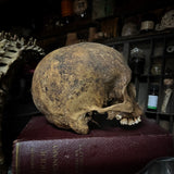 Human skull