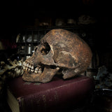 Human skull