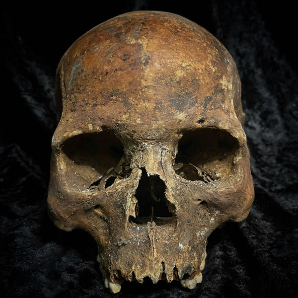 Human skull