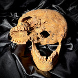 Item 15. Human skull with mandible