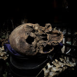 Human skull