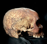 A human skull