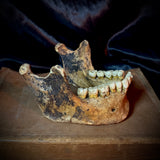 Item 9. Human mandible