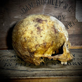 Human skull