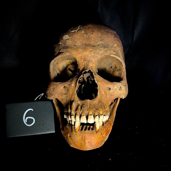 Item 6. Human skull with mandible