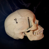 Item 5. Human medical skull