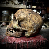 Human skull with mandible