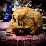 Human skull