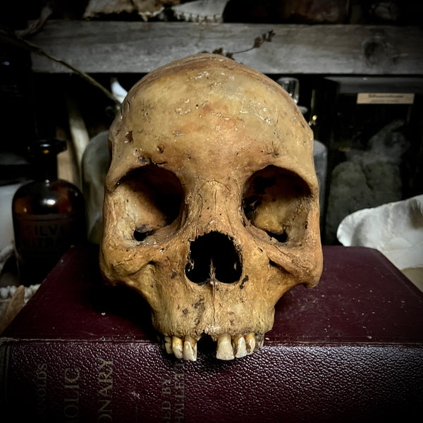 Human skull