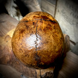 Human skull