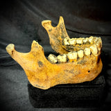 Item 10. Mandible