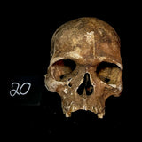 Item 20. Human skull