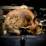 Human skull