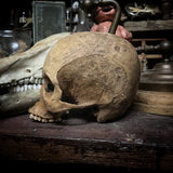 Human skull