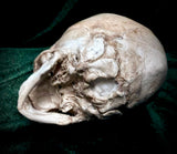 Human fetal skull