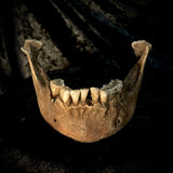 A mandible
