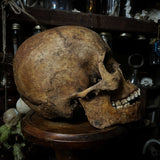 Human skull