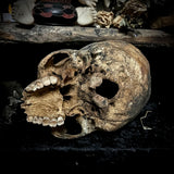 Human skull