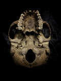 Human skull