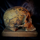 Item 7. Human skull