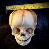 Item 1. Human fetal skull