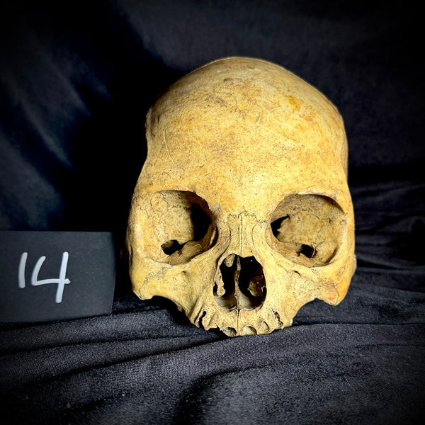 Item 14. Human skull