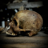 Human skull