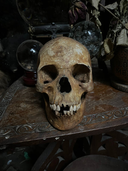 Human skull