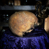 Partial Human skull