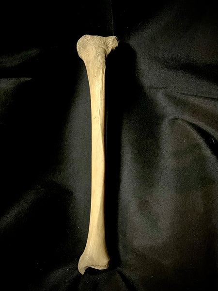 Human tibia (shinbone)