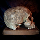 Item 11. Human skull