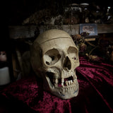 Adam Rouilly medical skull