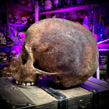 Human skull