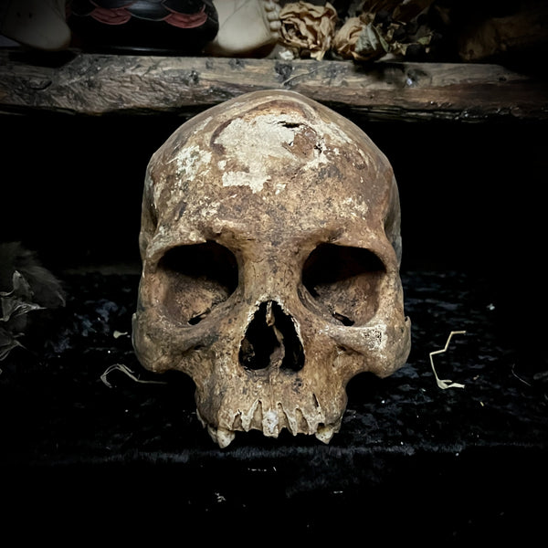 Human skull