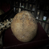 Human skull